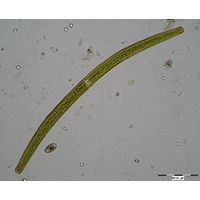 Closterium angustatum