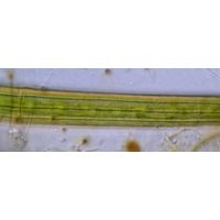 Closterium angustatum