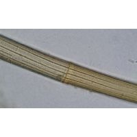 Closterium angustatum
