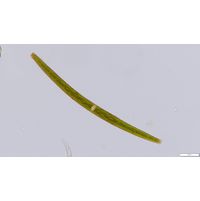 Closterium angustatum
