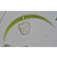 Closterium archerianum