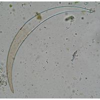 Closterium archerianum