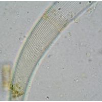 Closterium archerianum