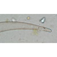 Closterium archerianum