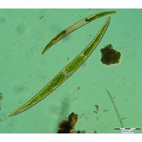 Closterium attenuatum