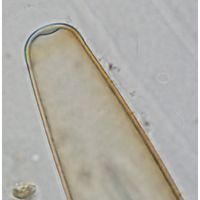 Closterium baillyanum