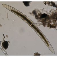 Closterium braunii
