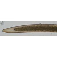 Closterium braunii