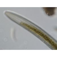 Closterium braunii