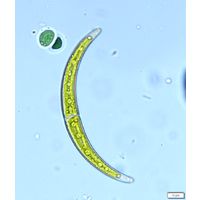 Closterium calosporum
