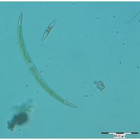 Closterium calosporum