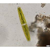 Closterium closterioides