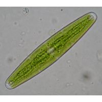 Closterium closterioides