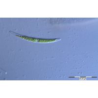 Closterium cornu
