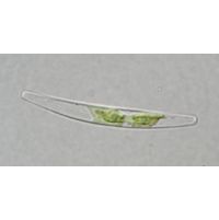 Closterium cornu