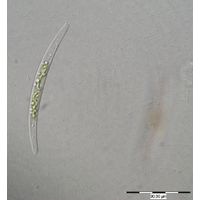Closterium cornu