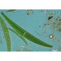 Closterium costatum