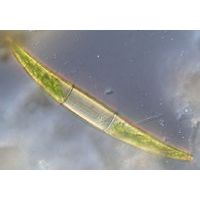 Closterium costatum
