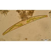 Closterium costatum
