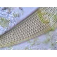 Closterium costatum