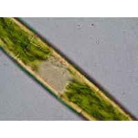 Closterium costatum