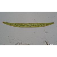 Closterium costatum