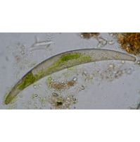 Closterium costatum