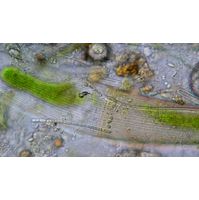 Closterium costatum