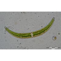 Closterium cynthia