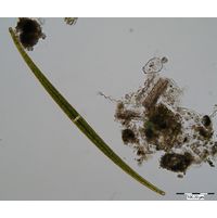 Closterium delpontei