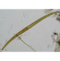Closterium delpontei