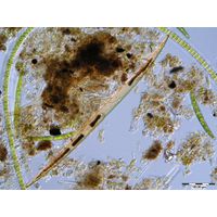 Closterium delpontei