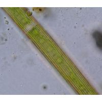 Closterium delpontei
