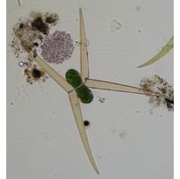 Closterium delpontei