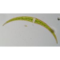 Closterium dianae