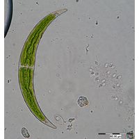 Closterium dianae