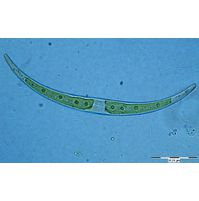 Closterium dianae