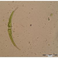 Closterium dianae