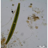 Closterium didymotocum