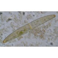 Closterium didymotocum