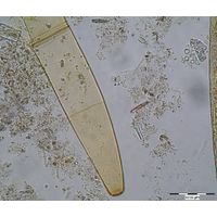 Closterium didymotocum