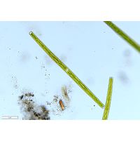 Closterium directum