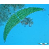Closterium ehrenbergii