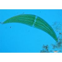 Closterium ehrenbergii