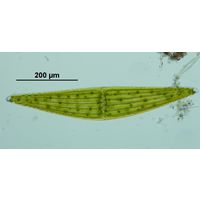 Closterium ehrenbergii