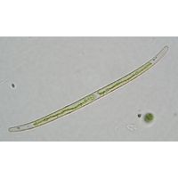 Closterium gracile