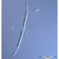 Closterium gracile