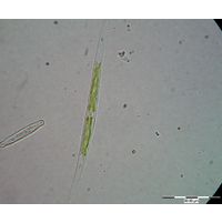Closterium idiosporum