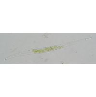 Closterium idiosporum
