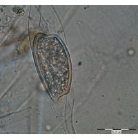 Closterium idiosporum